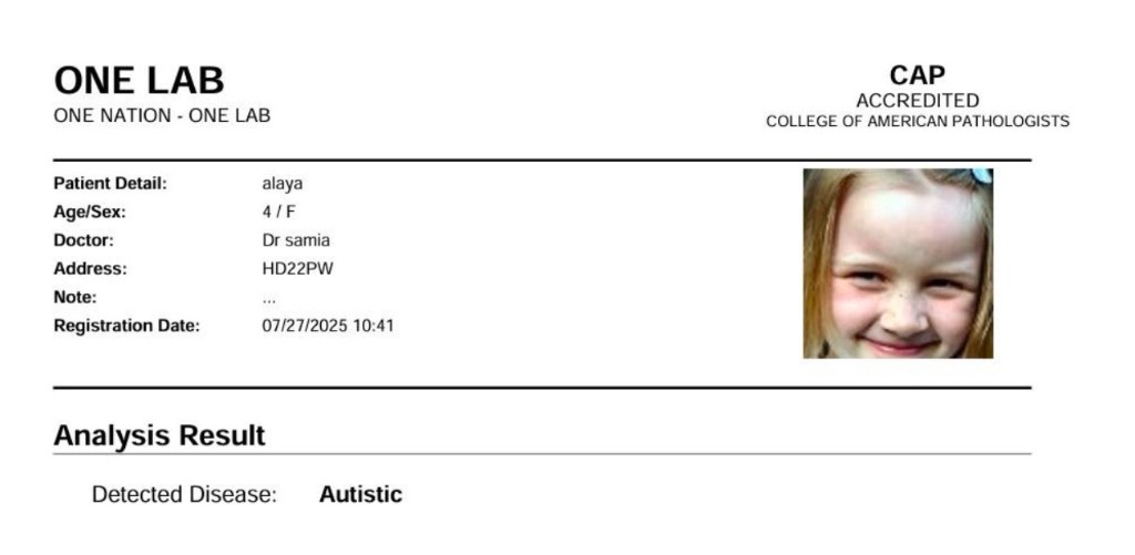 AI-Powered Autism Detection System project screenshot